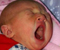 Big Yawn
