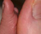 Big Feet
