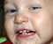 Dorky Grin